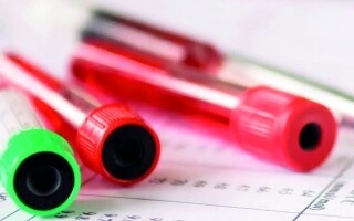 Ученые разработали новый анализ крови для раннего выявления рака поджелудочной железы