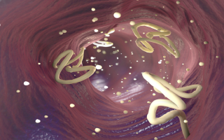 Shocking Case of Tapeworm Cysts in Florida
