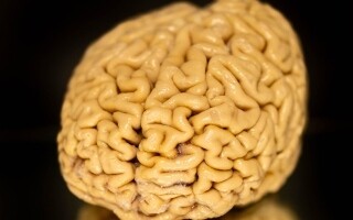 Super-Agers' Brain: How It Defeats Time